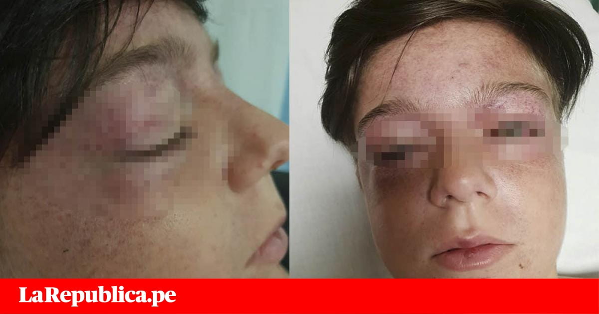Facebook: Niño tuvo